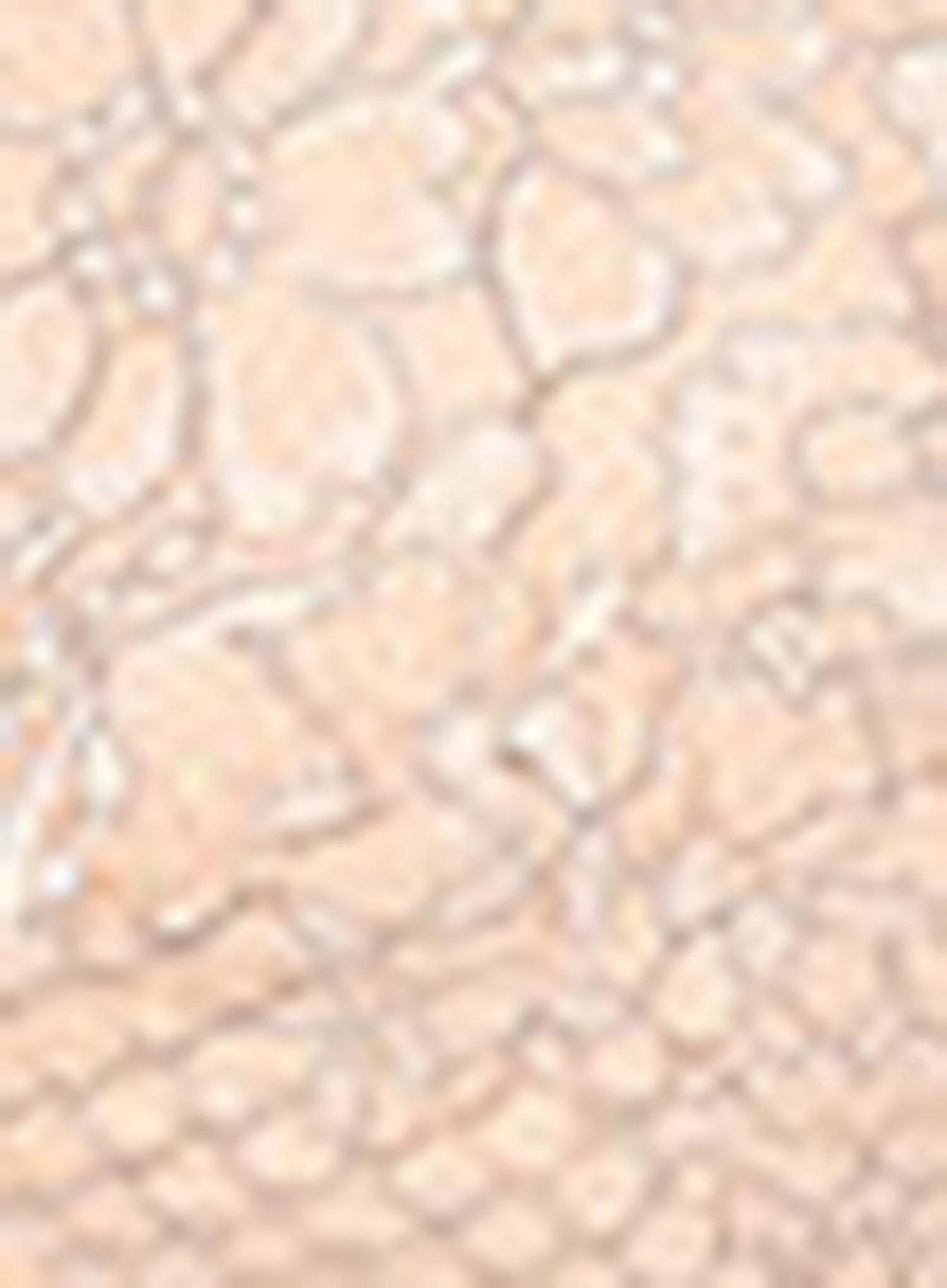 Amoena: Alina Soft Padded High Apex Soft Mastectomy Bra Light Rose Grey - Image 5